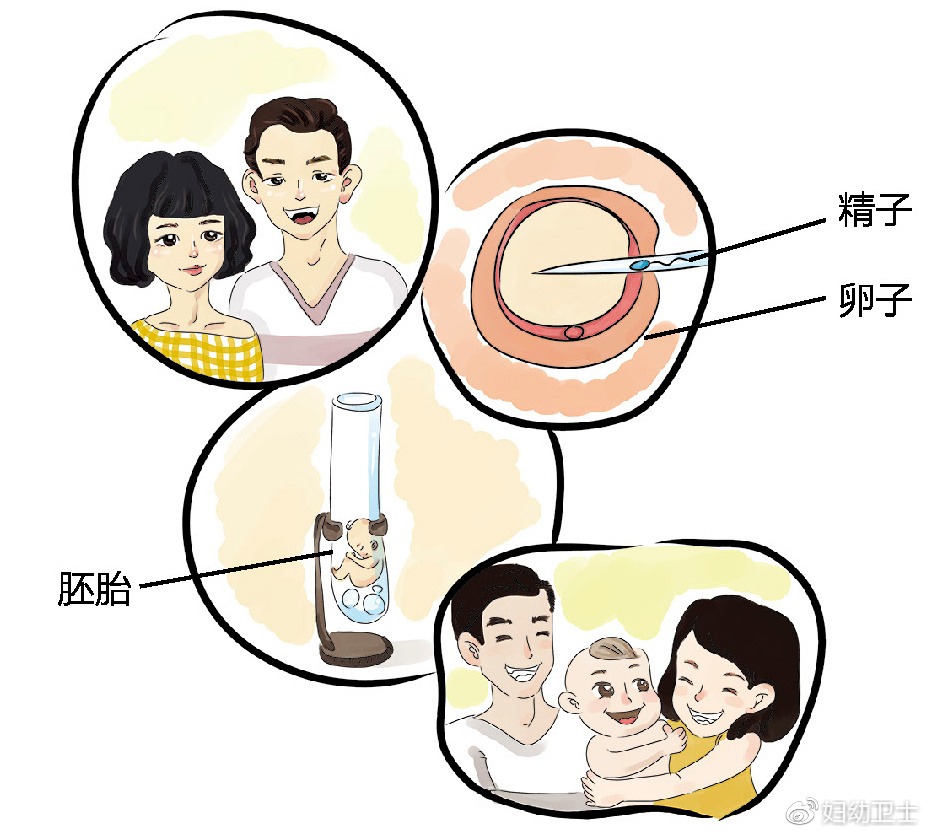 疑似宫内早早孕