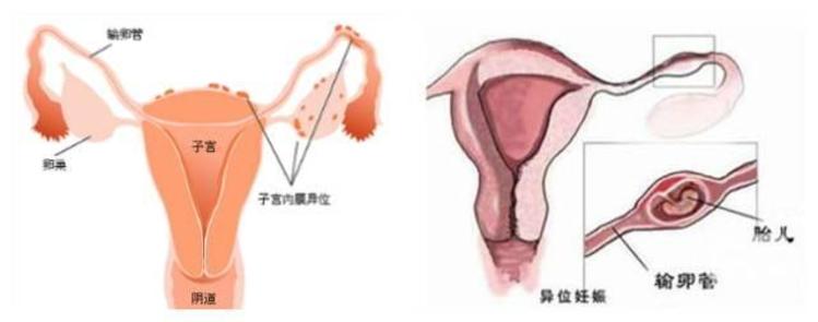 着床