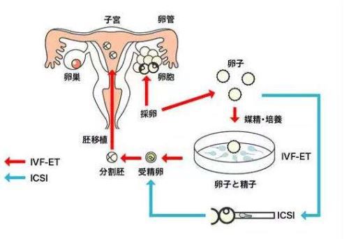 着床出血