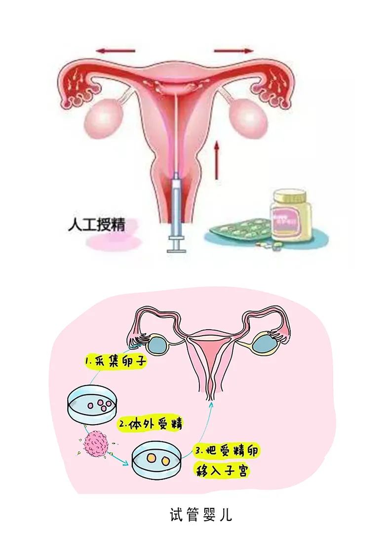 胎心