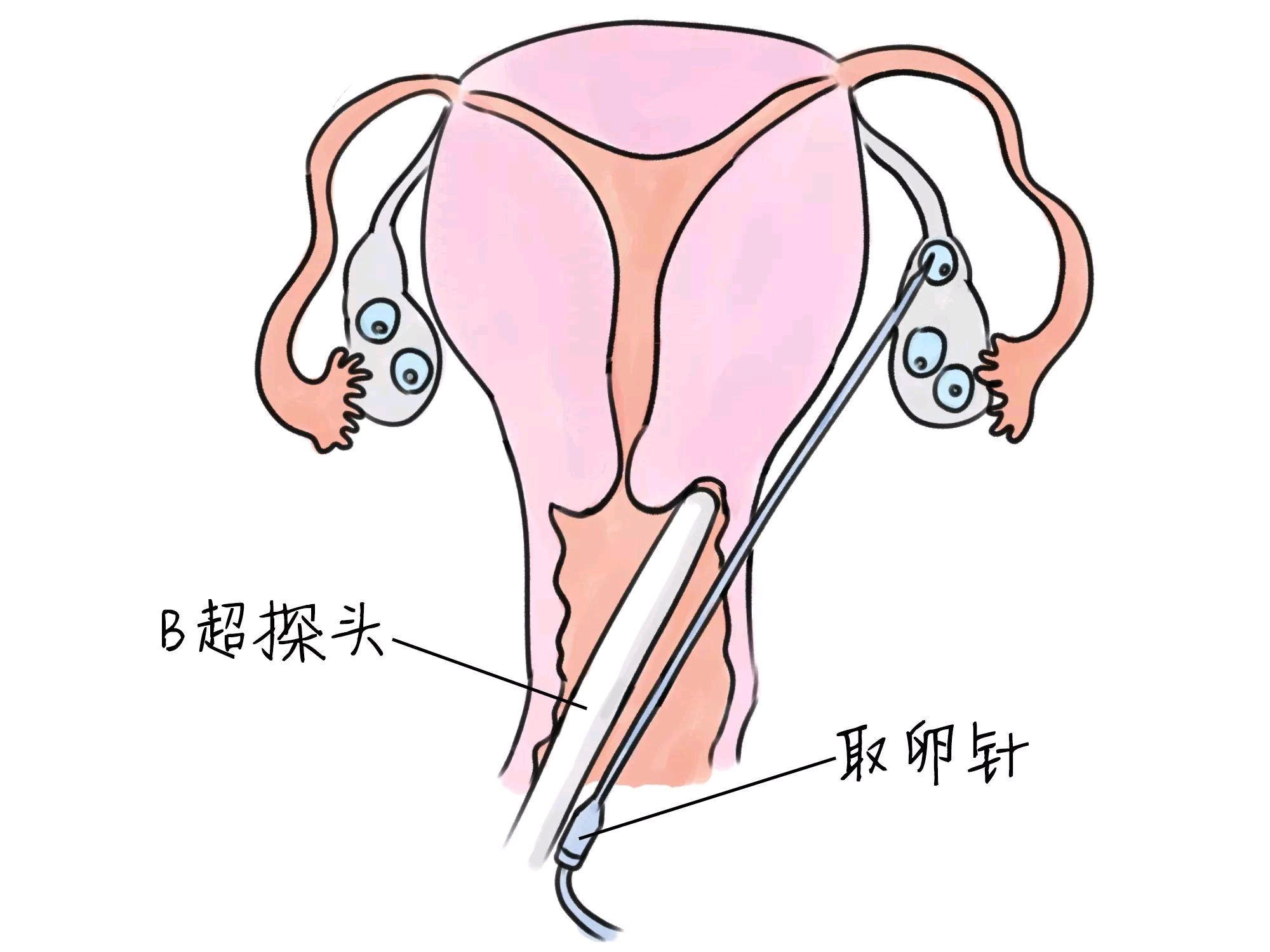 章泽天