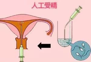 移植着床出血