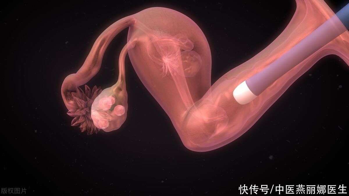 第一次人流
