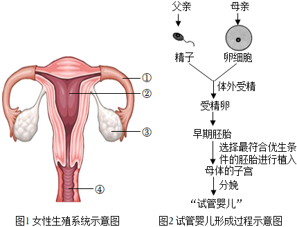 胚胎移植