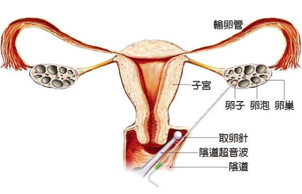 第一次查怀孕