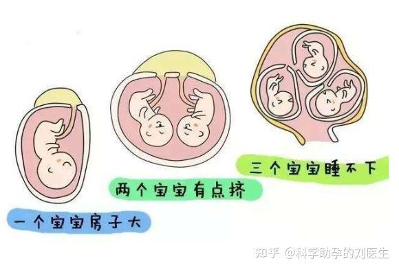 稽留流产