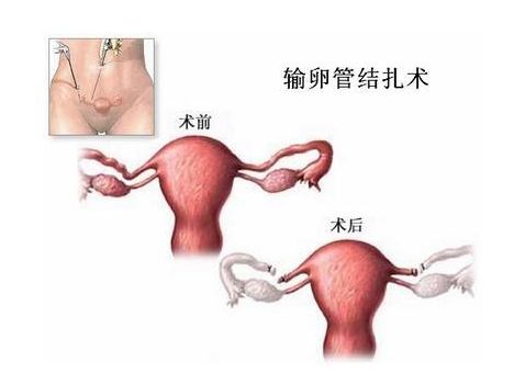 第一次查怀孕