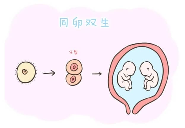 前置胎盘