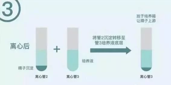 哈尔滨试管婴儿